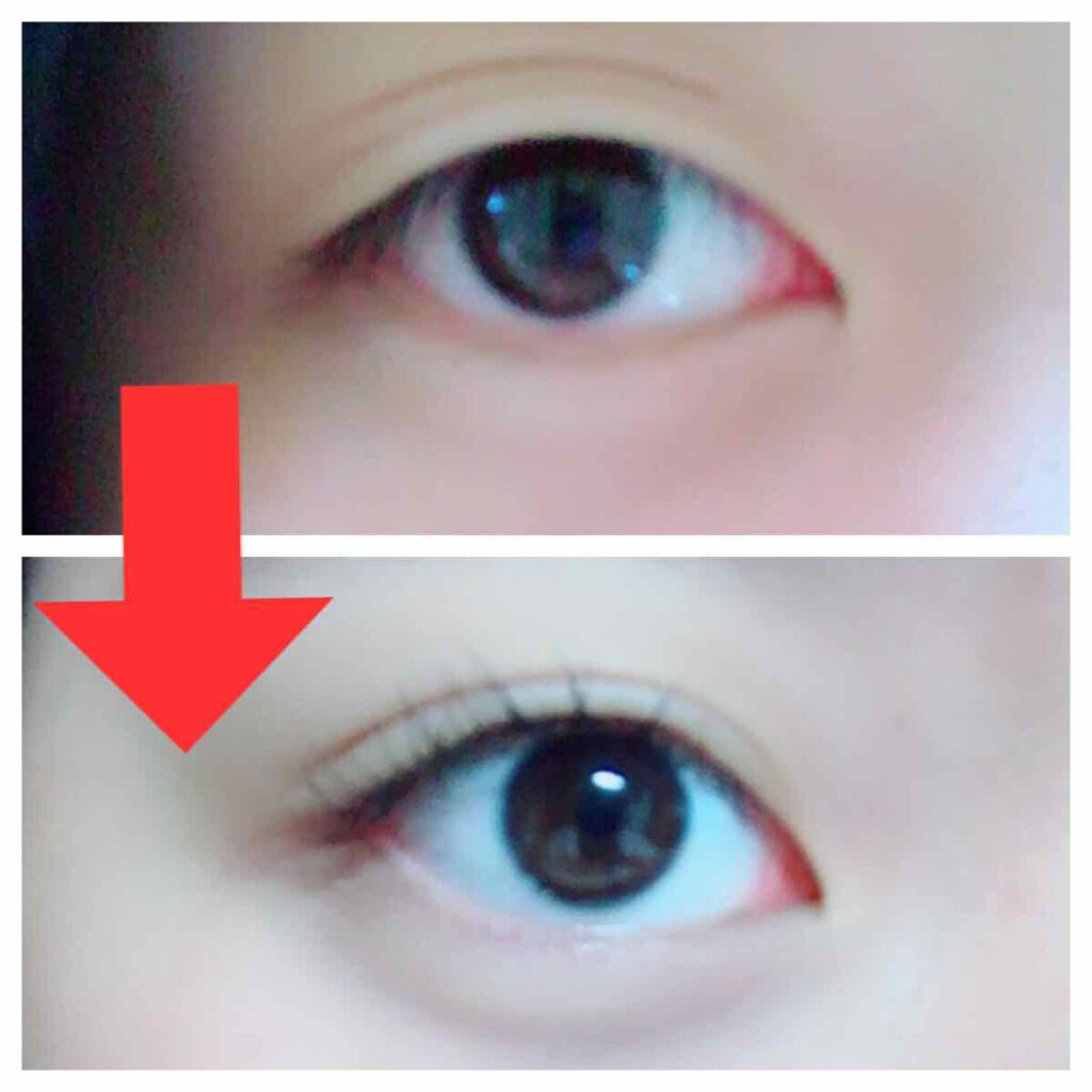 アイテープ/DAISO/二重まぶた用アイテムを使ったクチコミ（1枚目）