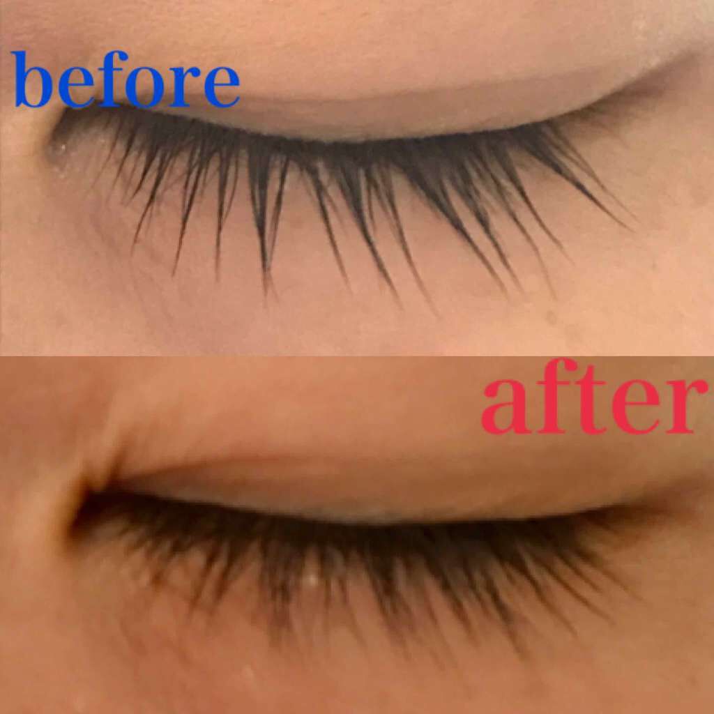 ローヤルゼリー配合 栄養ローション/DAISO/美容液を使ったクチコミ(1枚目)