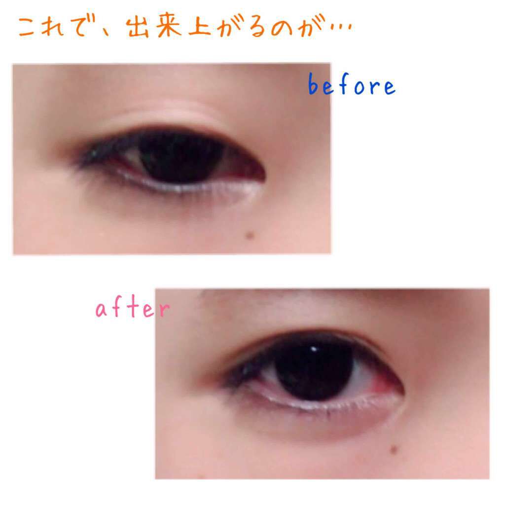 アイテープ 埋没式両面テープ/DAISO/二重まぶた用アイテムを使ったクチコミ(2枚目)