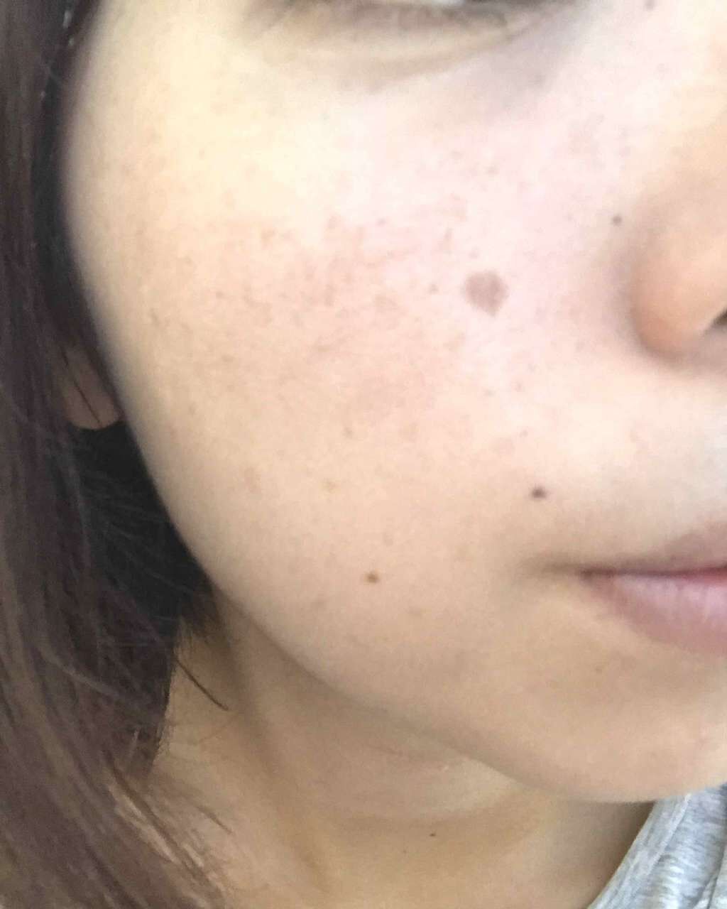 スポッツカバー ファウンデイション/SHISEIDO/クリームコンシーラーを使ったクチコミ(2枚目)