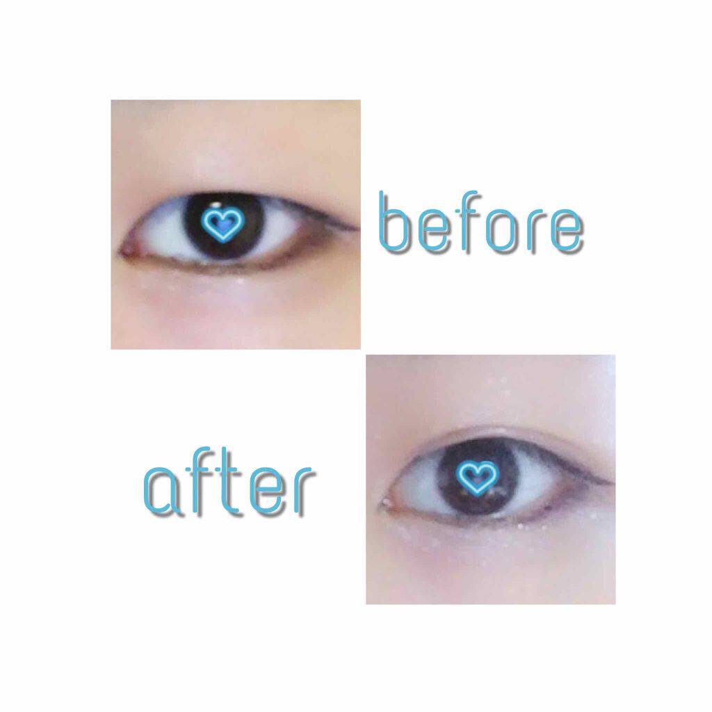 リキッドフィルム/ラクオリ/二重まぶた用アイテムを使ったクチコミ(3枚目)