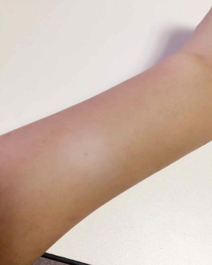 スポッツカバー ファウンデイション/SHISEIDO/クリームコンシーラーを使ったクチコミ(4枚目)