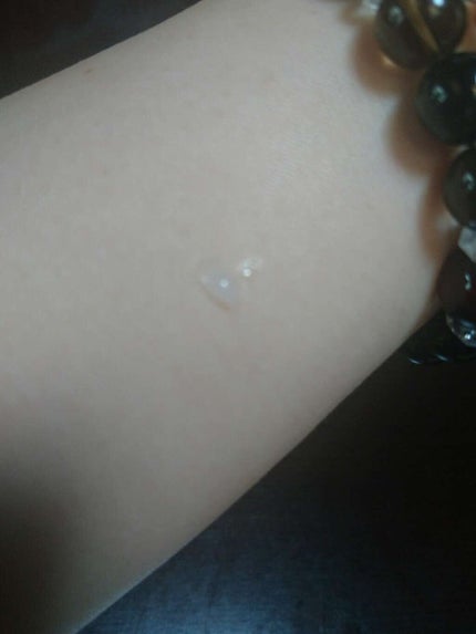 メディカルリップnc(医薬品)/メンソレータム/その他を使ったクチコミ(3枚目)