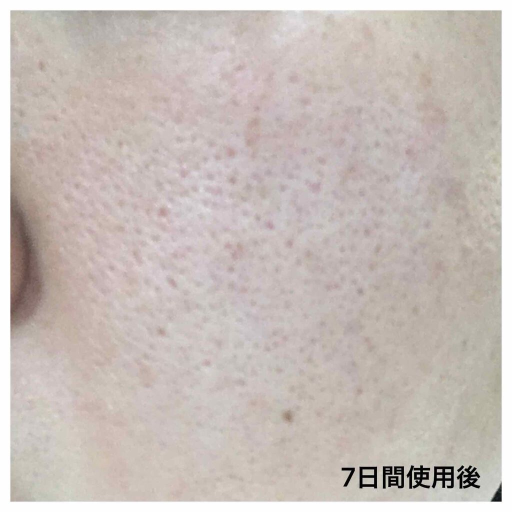 毛穴すっきり黒洗顔/黒糖精/洗顔フォームを使ったクチコミ(3枚目)