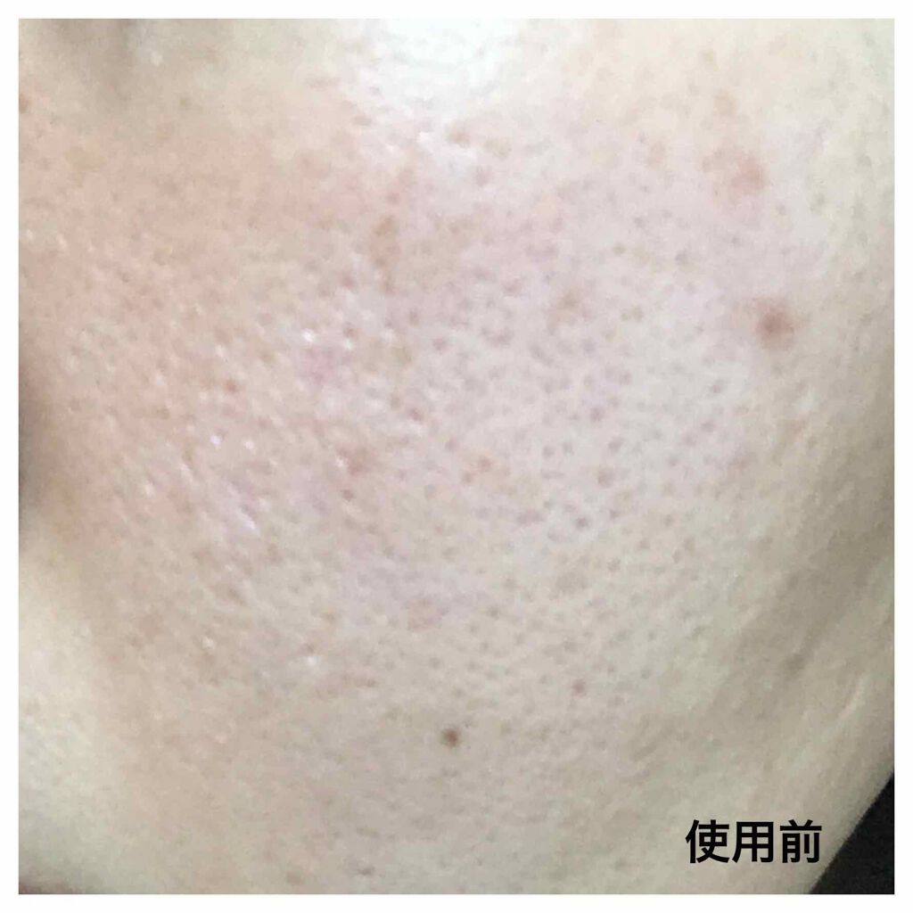 毛穴すっきり黒洗顔/黒糖精/洗顔フォームを使ったクチコミ(2枚目)