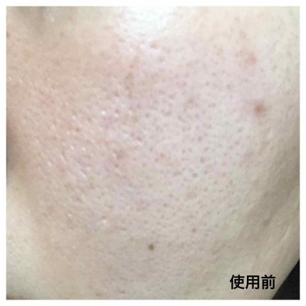 ルルルンピュア 青 (モイスト)/ルルルン/シートマスク・パックを使ったクチコミ(2枚目)