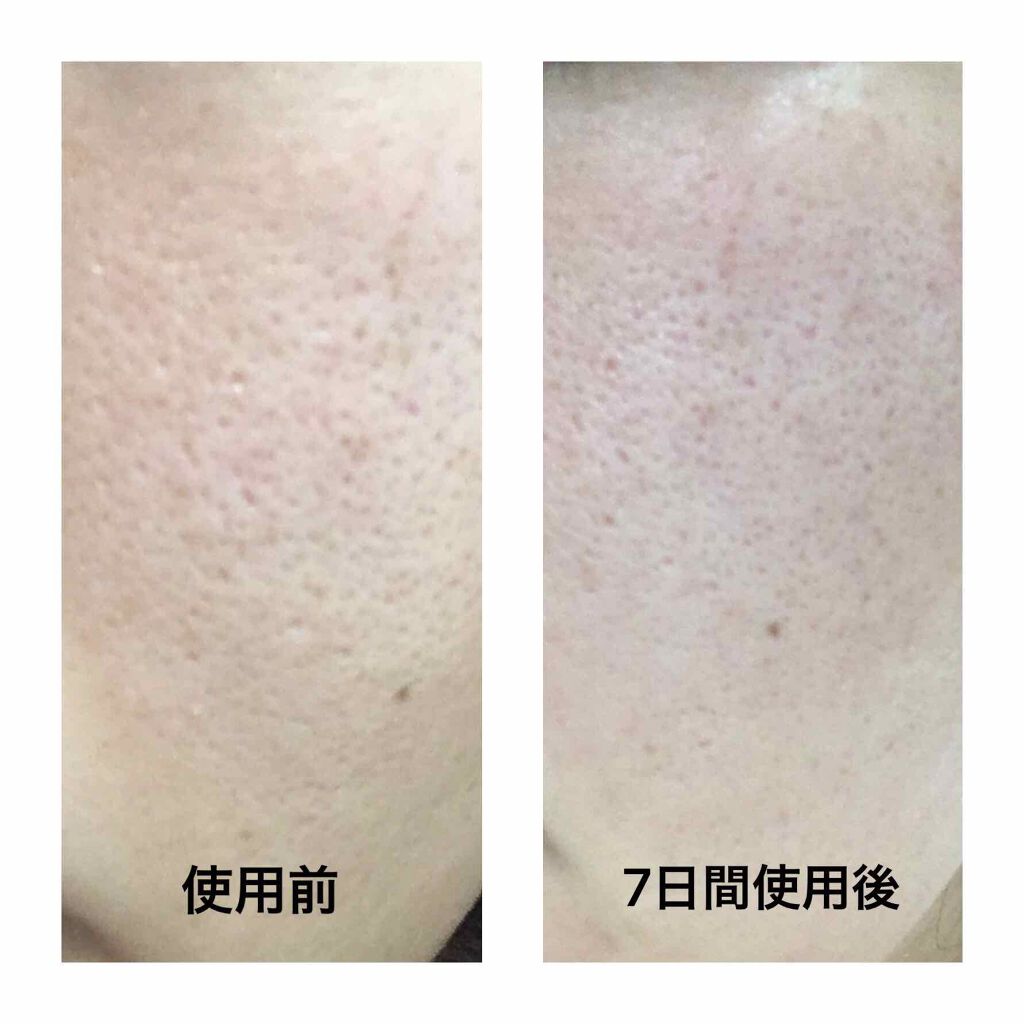 毛穴すっきり黒洗顔/黒糖精/洗顔フォームを使ったクチコミ(1枚目)