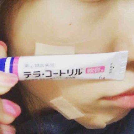 テラ・コートリル 軟膏(医薬品)/ジョンソン・エンド・ジョンソン/その他を使ったクチコミ(1枚目)