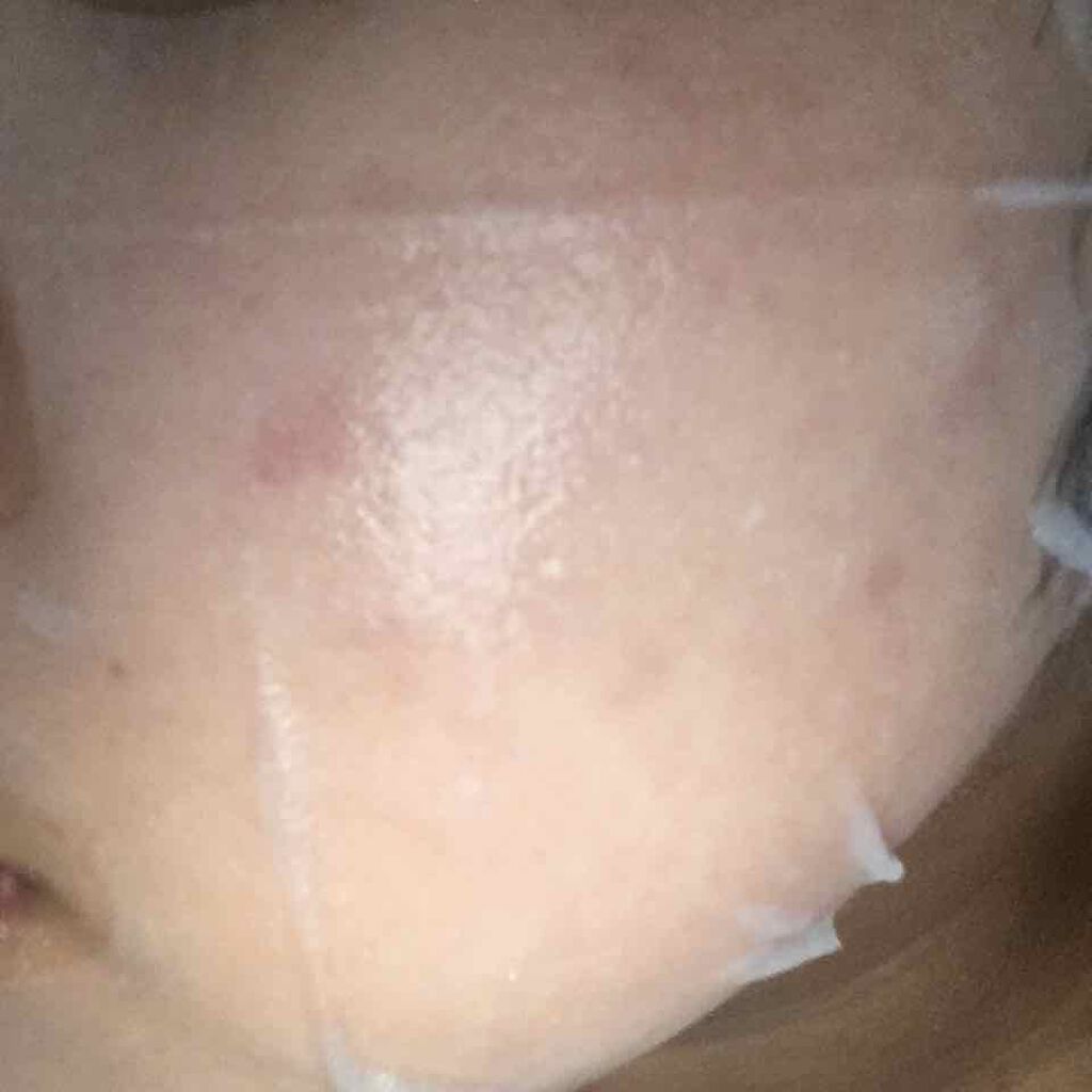 クリスタルモイスチャー アクアモイスチャー シートマスク/ALFACE+/シートマスク・パックを使ったクチコミ（1枚目）