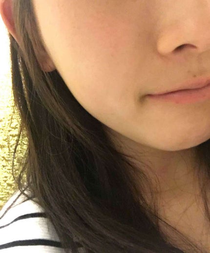 ハトムギ化粧水(ナチュリエ スキンコンディショナー R )/ナチュリエ/化粧水を使ったクチコミ(3枚目)