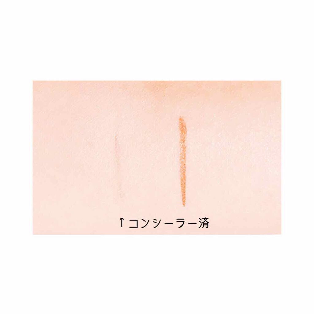 スポッツコンシーラー/インテグレート/リキッドコンシーラーを使ったクチコミ（2枚目）