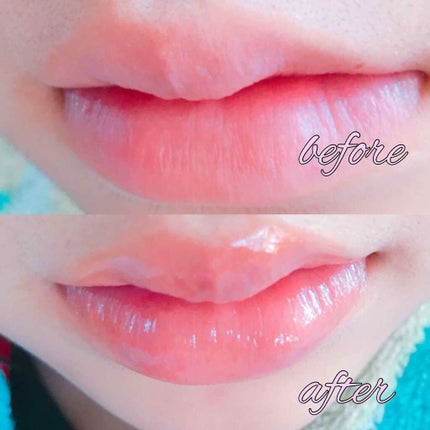 38°C / 99°F リップトリートメント (リップ美容液)/UZU BY FLOWFUSHI/リップケアを使ったクチコミ(3枚目)