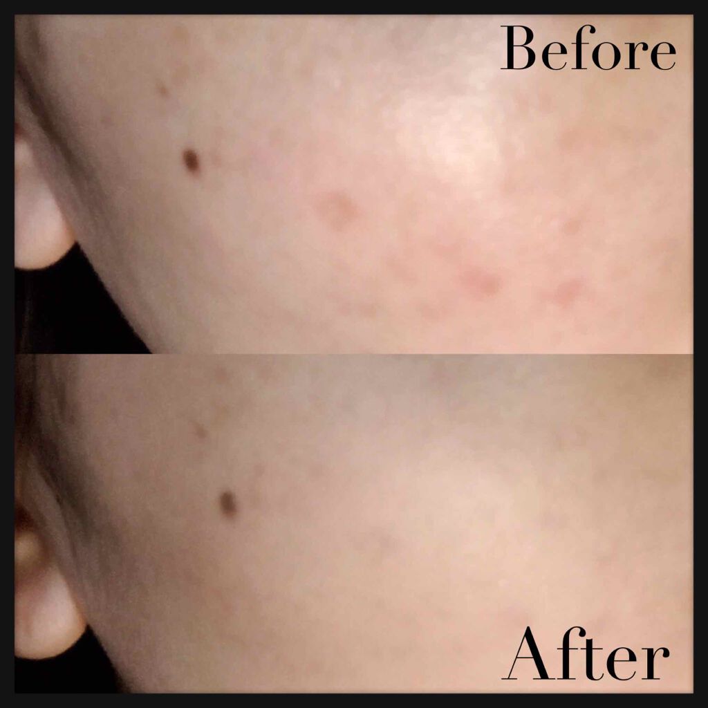 エクサージュ ホワイト サマーシフォンCR/ALBION/パウダーファンデーションを使ったクチコミ(2枚目)