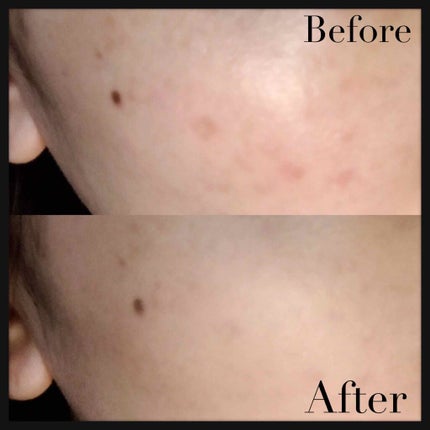 エクサージュ ホワイト サマーシフォンCR/ALBION/パウダーファンデーションを使ったクチコミ(2枚目)