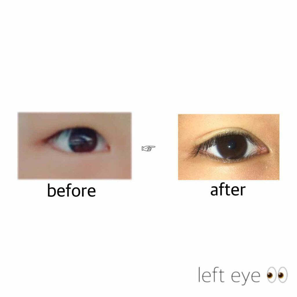 のびーるアイテープ（絆創膏タイプ、レギュラー）/DAISO/二重まぶた用アイテムを使ったクチコミ（1枚目）