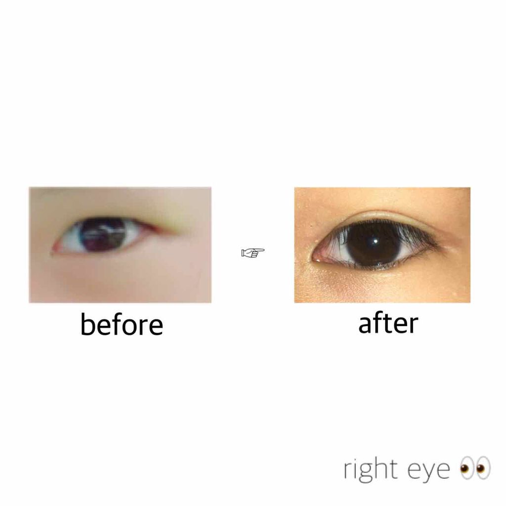 のびーるアイテープ(絆創膏タイプ、レギュラー)/DAISO/二重まぶた用アイテムを使ったクチコミ(2枚目)