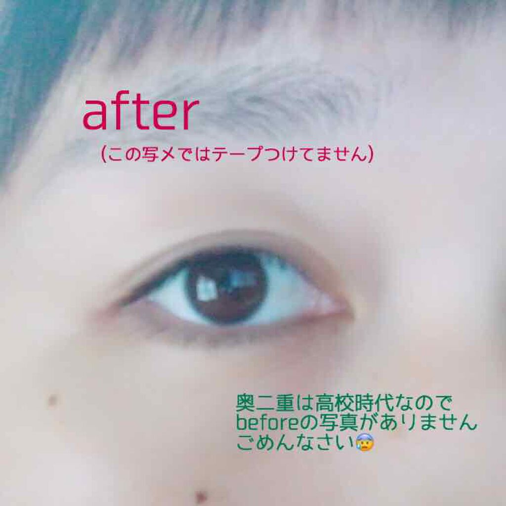 バイオリア アイテープ/エリザベス/二重まぶた用アイテムを使ったクチコミ(2枚目)