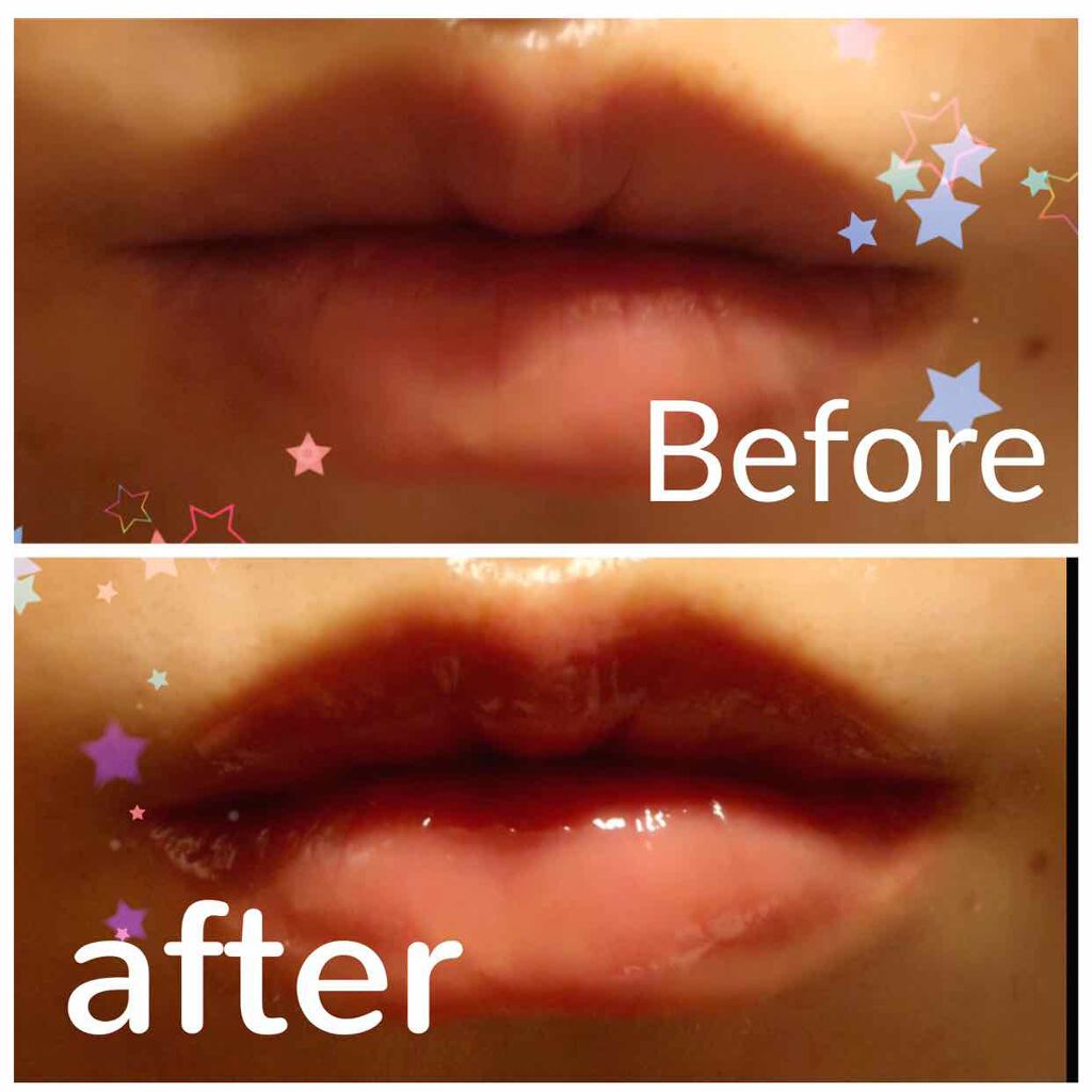 38°C / 99°F リップトリートメント (リップ美容液)/UZU BY FLOWFUSHI/リップケアを使ったクチコミ(4枚目)