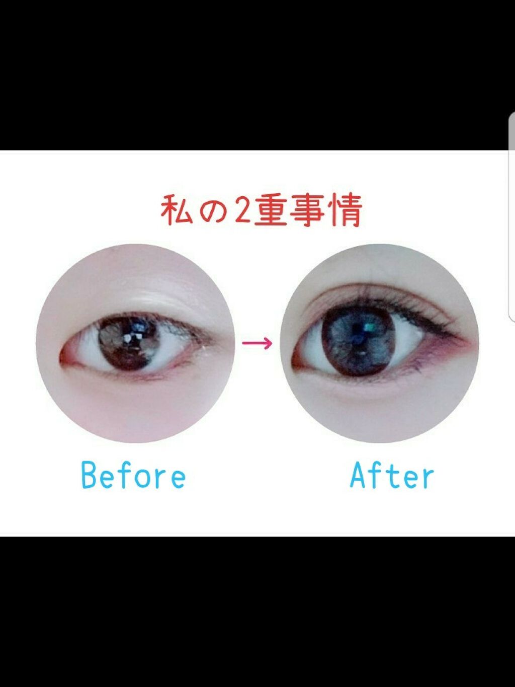 ふたえの衝撃 アイビューティーリキッド/ロージーローザ/二重まぶた用アイテムを使ったクチコミ(1枚目)