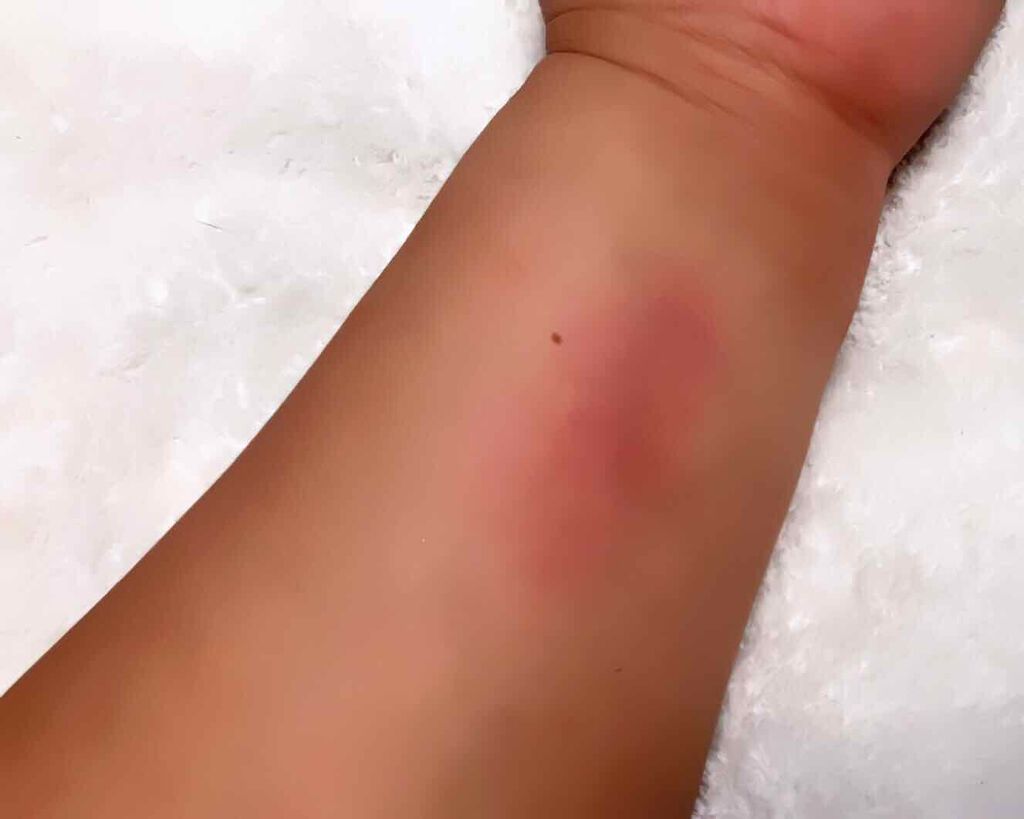 エピック ミニ ダッシュ/THREE/リキッドチークを使ったクチコミ(3枚目)