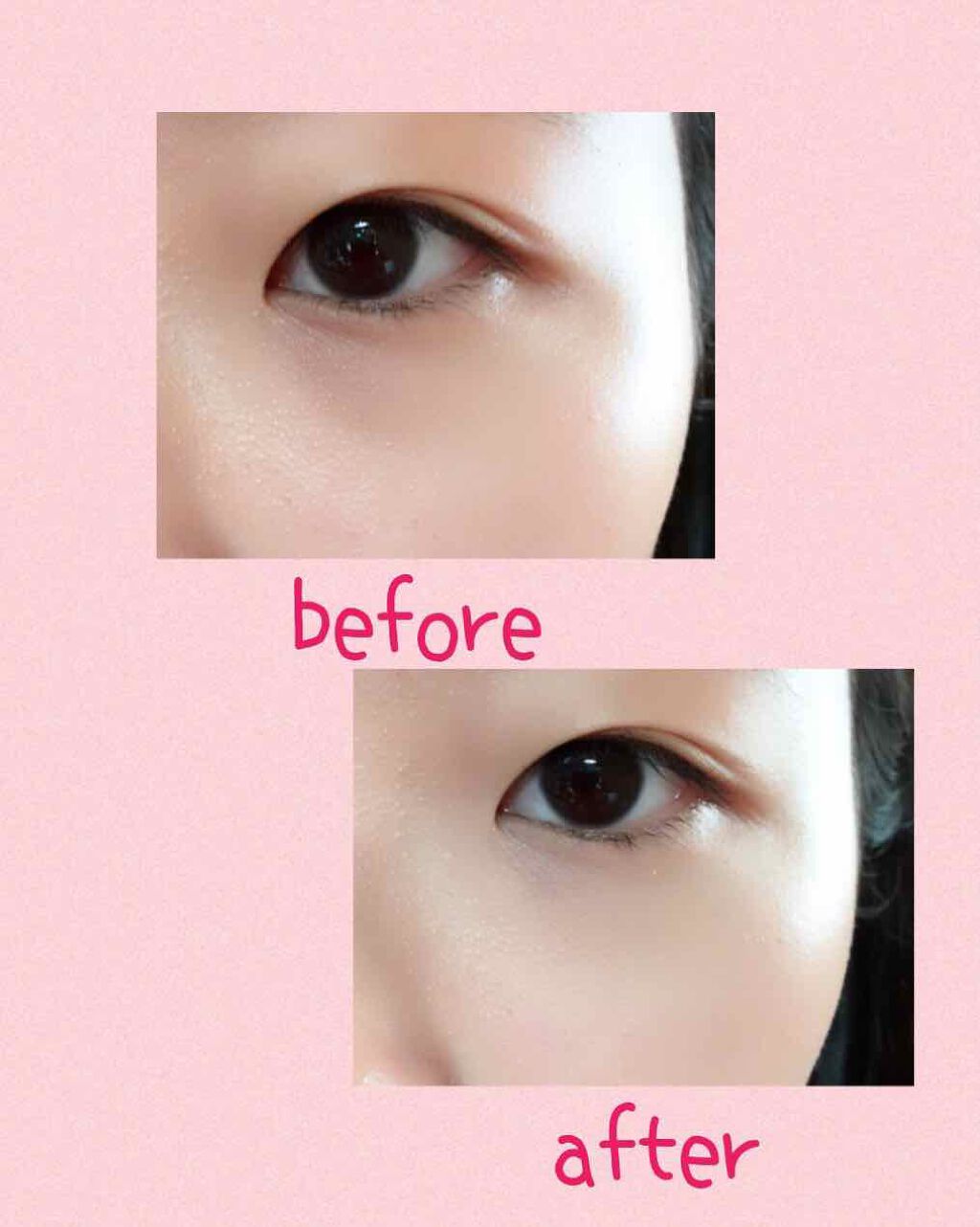 スポッツカバー ファウンデイション/SHISEIDO/クリームコンシーラーを使ったクチコミ(3枚目)