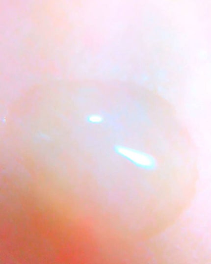 D濃密美容液 ヒアルロン酸/DAISO/美容液を使ったクチコミ(4枚目)