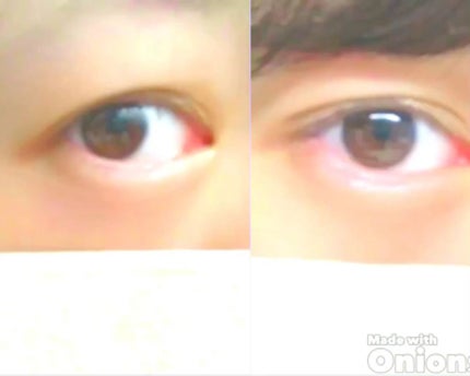 ローヤルプチアイム/ROYAL/二重まぶた用アイテムの動画クチコミ2つ目