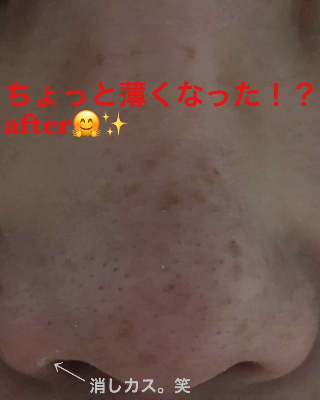 小鼻角質消しゴム/ポアナイス/ピーリングを使ったクチコミ(3枚目)