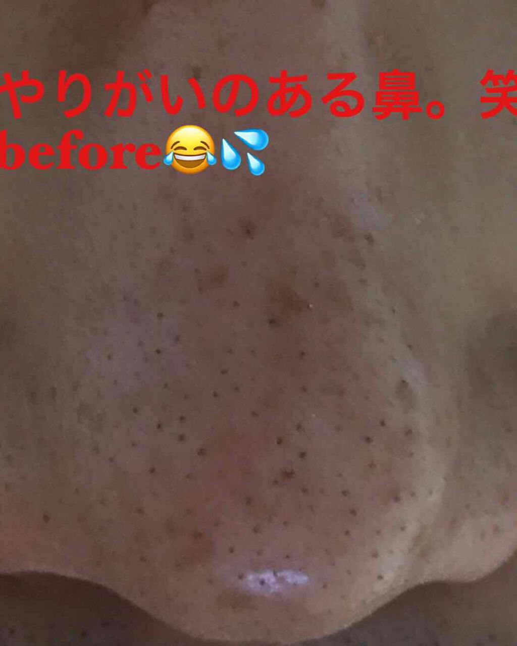 小鼻角質消しゴム/ポアナイス/ピーリングを使ったクチコミ(2枚目)