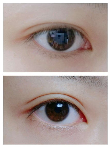 絆創膏/DAISO/その他を使ったクチコミ(1枚目)