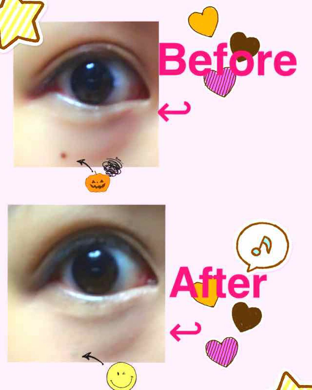 スポッツカバー ファウンデイション/SHISEIDO/クリームコンシーラーを使ったクチコミ（2枚目）