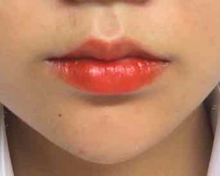 ディアダーリン ウォータージェルティント/ETUDE/リップティントを使ったクチコミ(2枚目)