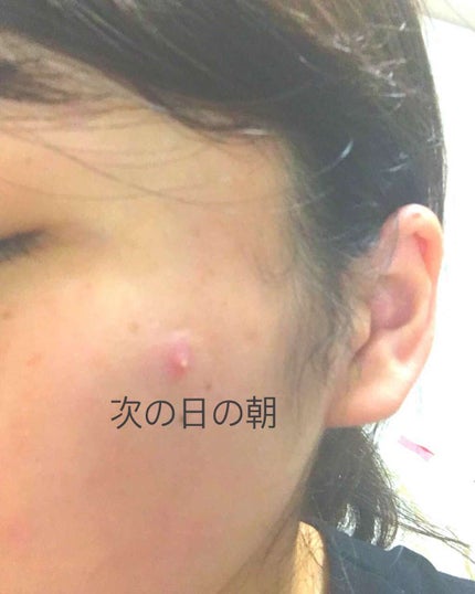 を使ったクチコミ(3枚目)