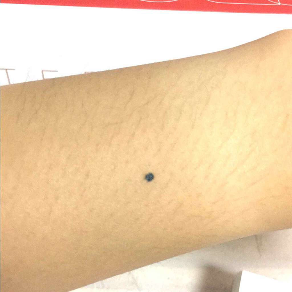 スポッツカバー ファウンデイション/SHISEIDO/クリームコンシーラーを使ったクチコミ(2枚目)