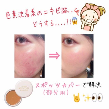 スポッツカバー ファウンデイション/SHISEIDO/クリームコンシーラーを使ったクチコミ（1枚目）