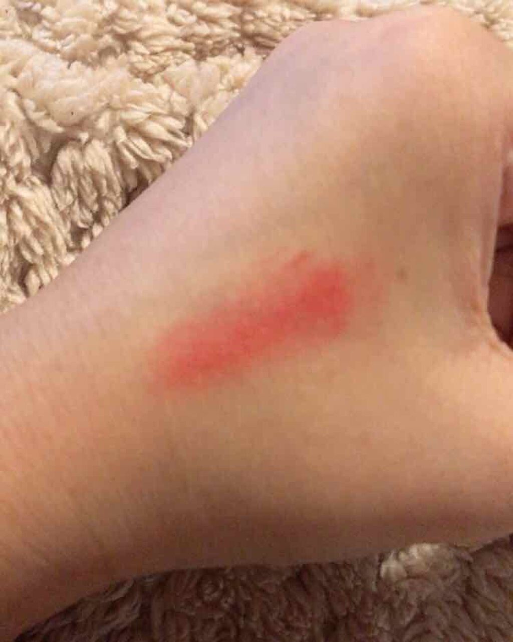 リシェ リップ&チーク クリーム/Visée/ジェル・クリームチークを使ったクチコミ(3枚目)