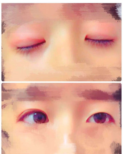 アイテープ(絆創膏タイプ、レギュラー、70枚)/DAISO/二重まぶた用アイテムを使ったクチコミ(2枚目)