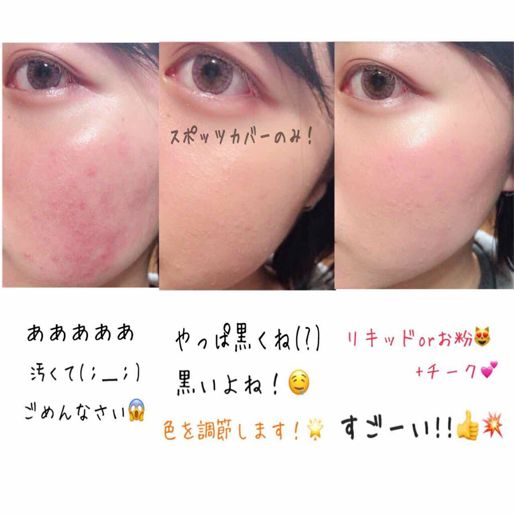 スポッツカバー ファウンデイション/SHISEIDO/クリームコンシーラーを使ったクチコミ(2枚目)