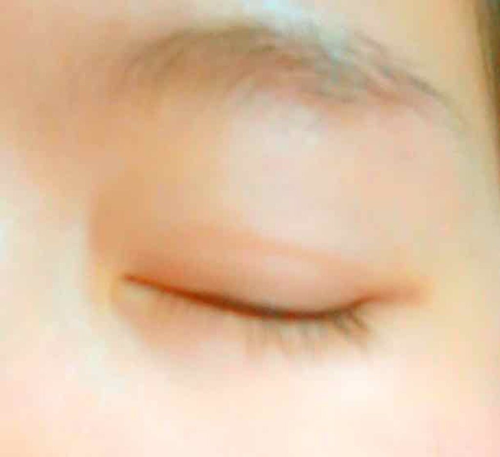 のびーるアイテープ（絆創膏タイプ、レギュラー）/DAISO/二重まぶた用アイテムを使ったクチコミ（2枚目）