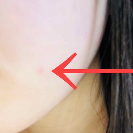 スポッツカバー ファウンデイション/SHISEIDO/クリームコンシーラーを使ったクチコミ(3枚目)