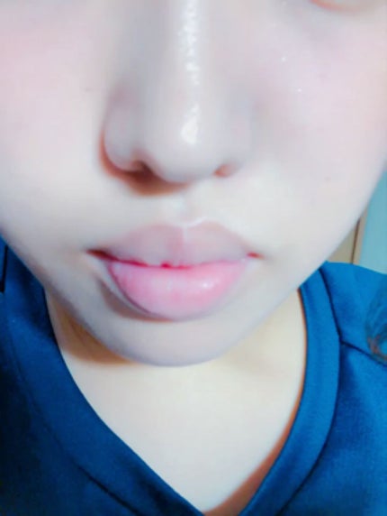 38°C / 99°F リップトリートメント (リップ美容液)/UZU BY FLOWFUSHI/リップケアを使ったクチコミ(2枚目)