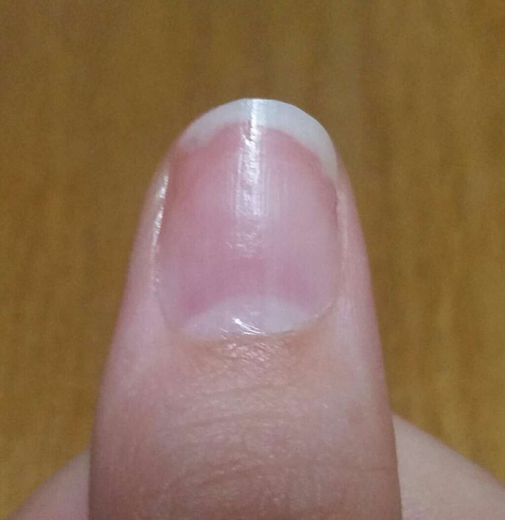 エテュセ クイックケアコート/ettusais/ネイルオイル・トリートメントを使ったクチコミ(3枚目)