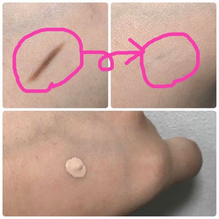 マジックコンシーラー/カリプソ/リキッドコンシーラーを使ったクチコミ(2枚目)