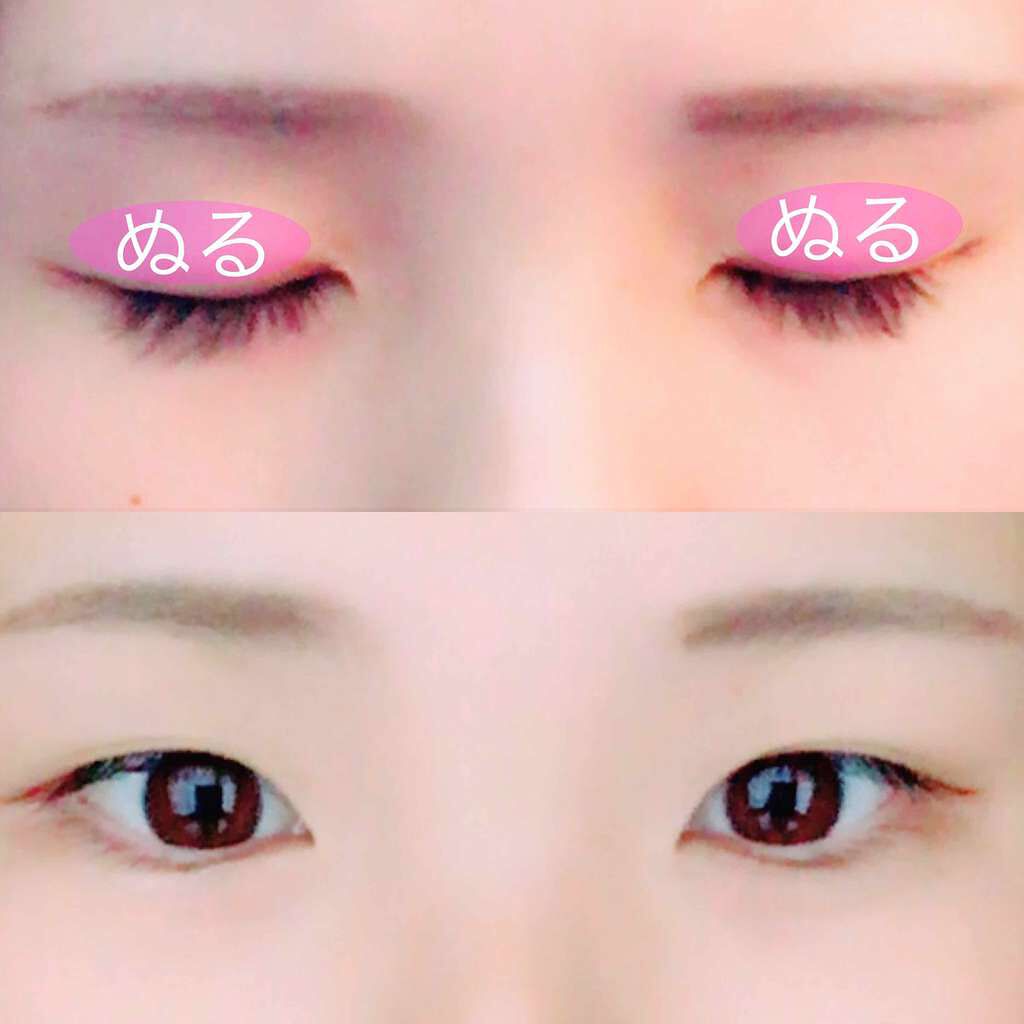 アイトーク/アイトーク/二重まぶた用アイテムを使ったクチコミ(2枚目)