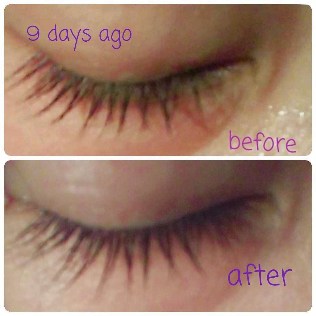 スカルプD ボーテ ピュアフリーアイラッシュセラム/アンファー(スカルプD)/まつげ美容液を使ったクチコミ(1枚目)