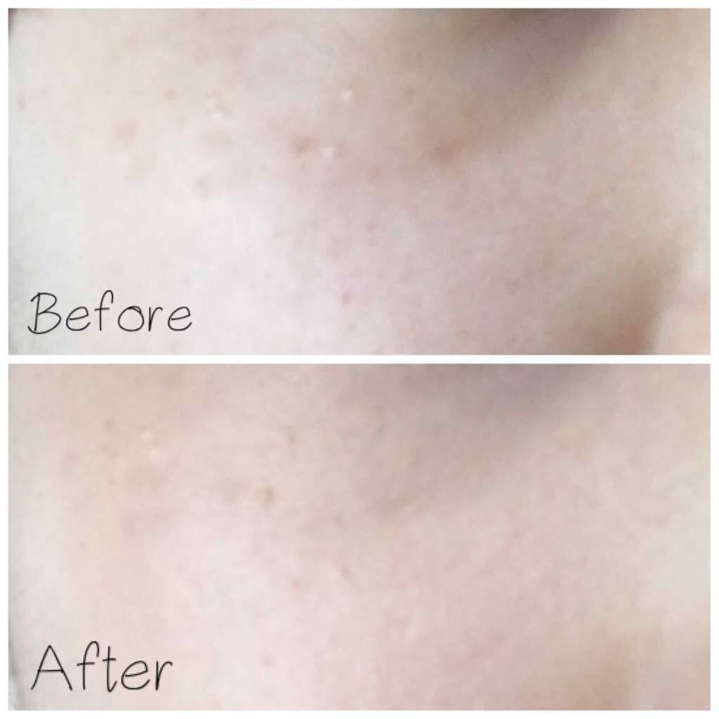 エッセンススキンファンデーションパクト/VT/クリーム・エマルジョンファンデーションを使ったクチコミ(3枚目)