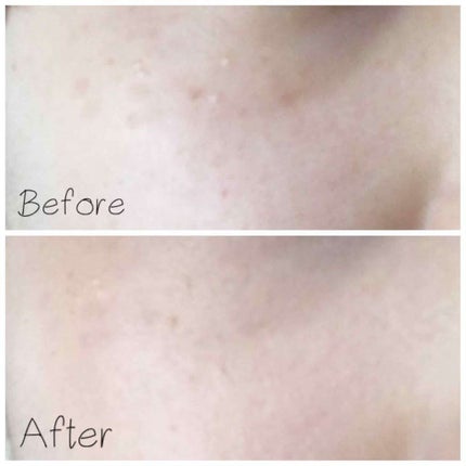 エッセンススキンファンデーションパクト/VT/クリーム・エマルジョンファンデーションを使ったクチコミ(3枚目)