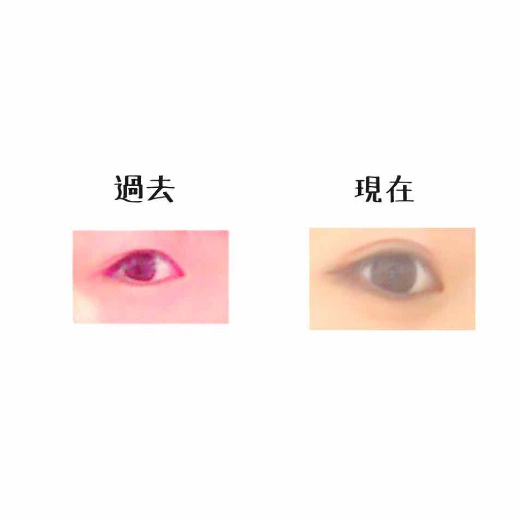 ナイトアイボーテ/StreeTrend/二重まぶた用アイテムを使ったクチコミ(1枚目)