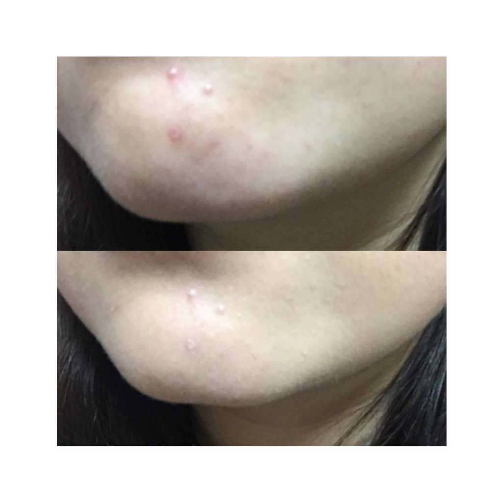 ミネラルCCクリーム NM(ナチュラルマット)/毛穴パテ職人/CCクリームを使ったクチコミ(4枚目)