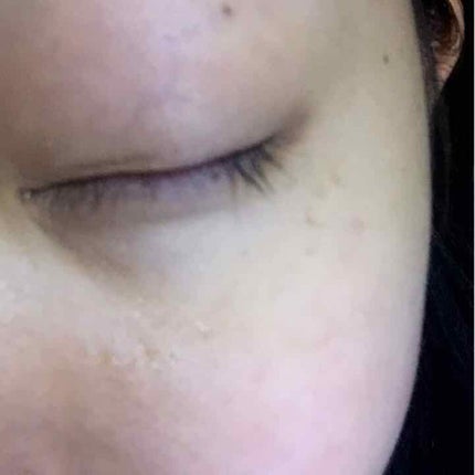 DHCアイラッシュトニック/DHC/まつげ美容液を使ったクチコミ(2枚目)